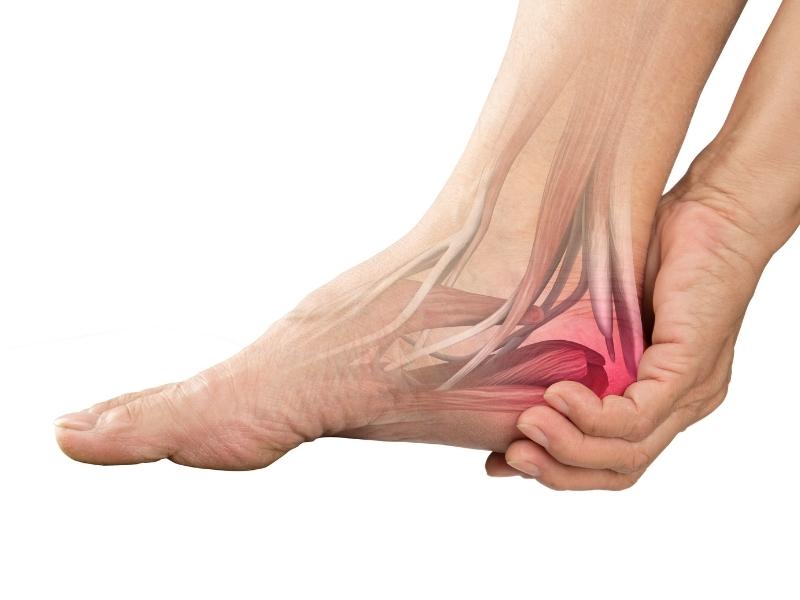 Heel pain foot graphic displaying the muscles of the foot being held in a hand